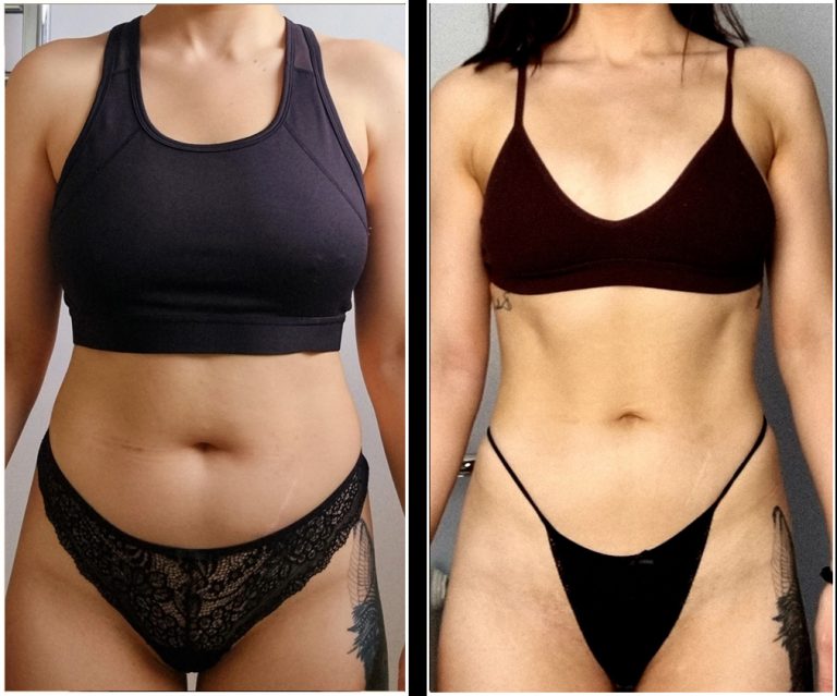 A side-by-side comparison of a woman showing her body transformation. In the left image, she is wearing a black sports bra and lacy black underwear, and in the right image, she is wearing a black bralette and black underwear.